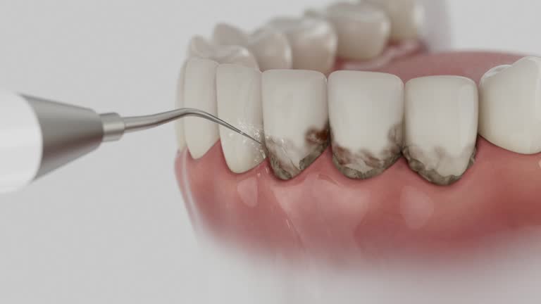 Trusted Teeth Cleaning And Checkup service in Fyffe, AL - Dentist Open Now